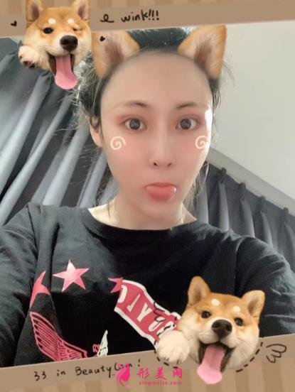 上海伯思立沈国雄鼻修复怎么样?专家案例和价格表参考如下!