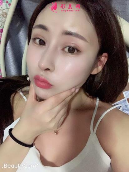 上海伯思立沈国雄鼻修复怎么样?专家案例和价格表参考如下!