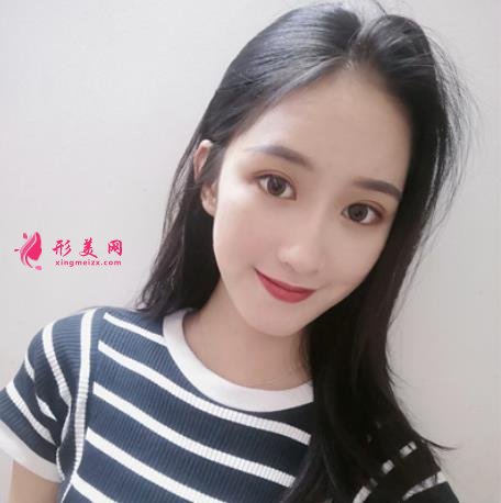 上海九院口腔科种植牙专家哪个好?真人案例及价格收费展现!