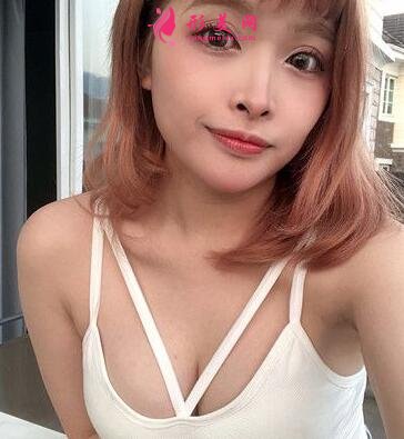 武汉协和整形科自体脂肪隆胸案例反馈如下!还有整形价格收费表参考