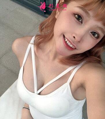 武汉协和整形科自体脂肪隆胸案例反馈如下!还有整形价格收费表参考