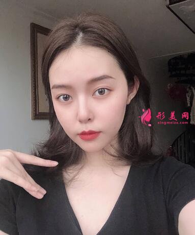 长春海峡整形医院植发咋样?案例效果_价格收费表请查收~