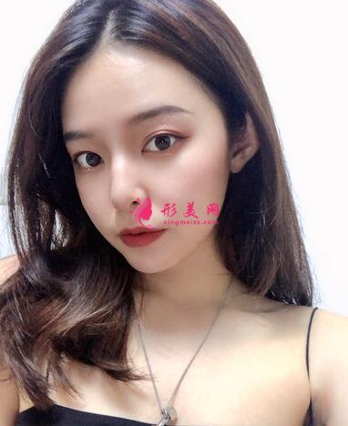 长春海峡整形医院植发咋样?案例效果_价格收费表请查收~