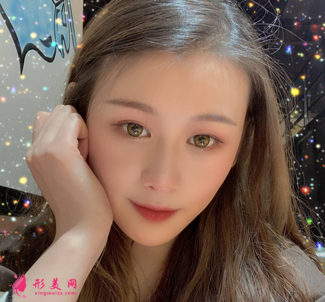 佛山禅城中心医院整形磨骨咋样?案例效果反馈_整形价格同步一览