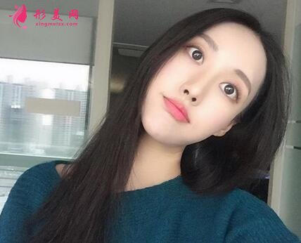 北京八大处整形医院热玛吉怎么样?案例_价格表收费标准一览