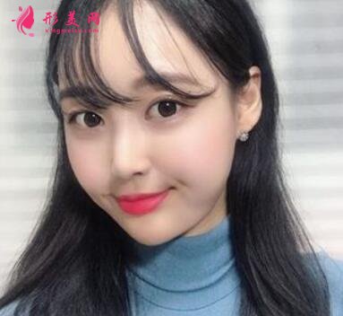 北京八大处整形医院热玛吉怎么样?案例_价格表收费标准一览