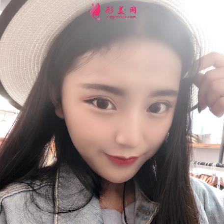 北京协和医院双眼皮多少钱？真人效果术后图、价格表清单一一公布！