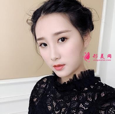 无锡曼陀罗医院上脸下垂矫正案例_整形美容价格表请查收！