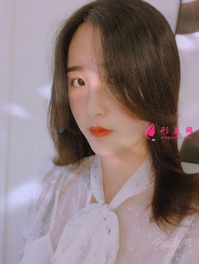 无锡曼陀罗医院上脸下垂矫正案例_整形美容价格表请查收！