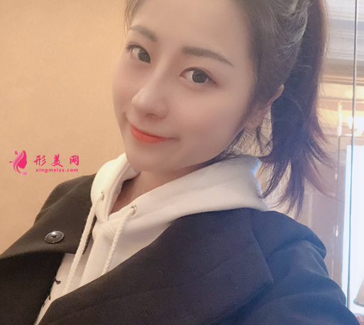 深圳美莱整形美容医院隆鼻案例反馈如下~还有价格收费表明细参考