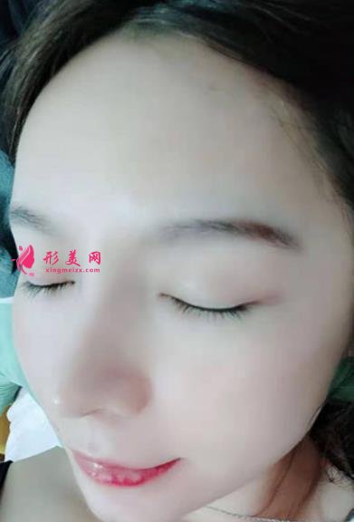 2021上海九院戴传昌做鼻子价格表!在对比真人隆鼻案例实拍