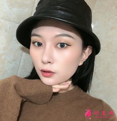 深圳阳光整形医院双眼皮怎么样？效果好吗？手术真实价格费用参考