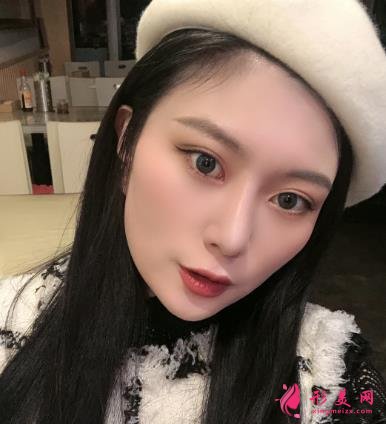 深圳阳光整形医院双眼皮怎么样？效果好吗？手术真实价格费用参考