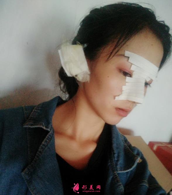 武汉同济医院整形科(公立)价格收费标准更新!隆鼻案例全面公开~