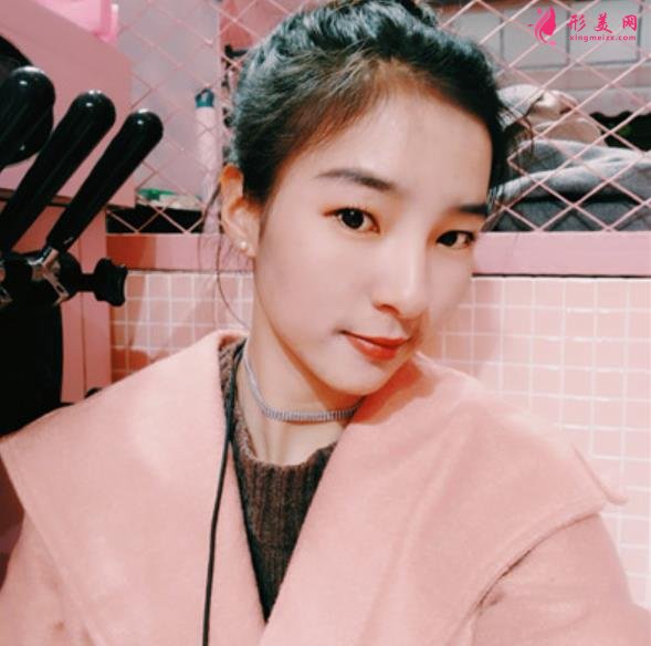 武汉同济医院整形科(公立)价格收费标准更新!隆鼻案例全面公开~