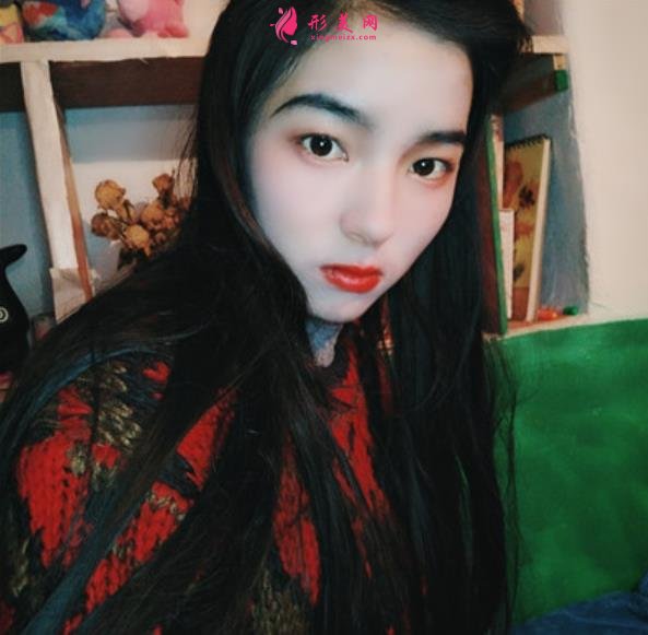 武汉同济医院整形科(公立)价格收费标准更新!隆鼻案例全面公开~