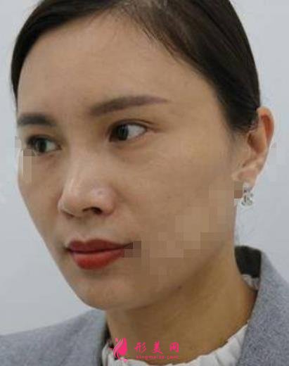 松原口碑好的整形医院有哪些？排名前三权威发布_阳光、海峡实力领衔