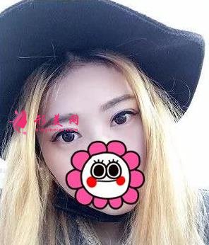 唐山金荣是三甲医院吗?双眼皮案例及价格表一览!