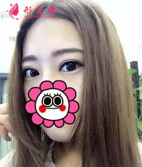 唐山金荣是三甲医院吗?双眼皮案例及价格表一览!