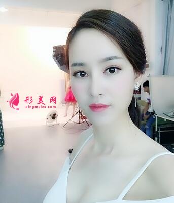 重庆市中山医院整形美容科价格表,附隆鼻案例效果对比图