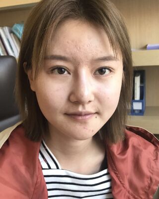 太原美之妍曹立铭面部吸脂瘦脸手术效果图