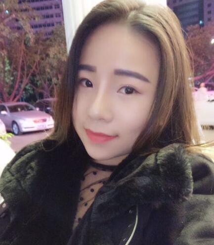 在宁波尚美医院做的鼻子综合整形效果不错