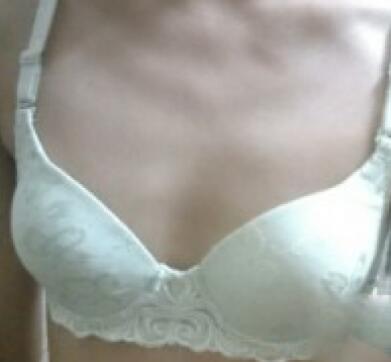 自体脂肪隆胸对比图和恢复过程分享,手感真实