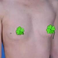 唐山美仁整形美容医院做的假体隆胸手术恢复过程分享