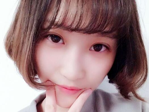 切开双眼皮多少钱?割双眼皮真实案例多对比图分享