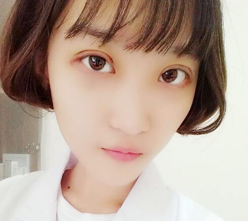 切开双眼皮多少钱?割双眼皮真实案例多对比图分享