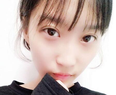 切开双眼皮多少钱?割双眼皮真实案例多对比图分享