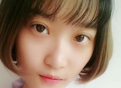 切开双眼皮多少钱?割双眼皮真实案例多对比图分享