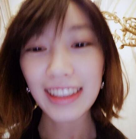 牙齿矫正前后对比图,成人牙齿矫正费用9800元——成都格林口腔医院