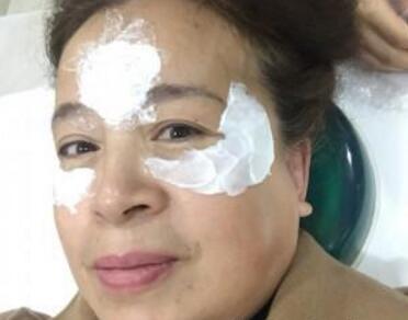 去抬头纹最好的方法?肉毒素去抬头纹鱼尾纹