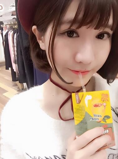 杭州王圣林全切双眼皮恢复过程图