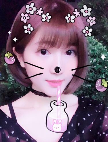 杭州王圣林全切双眼皮恢复过程图