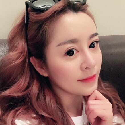 天津圣韩美鼻综合+脂肪移植恢复期图片