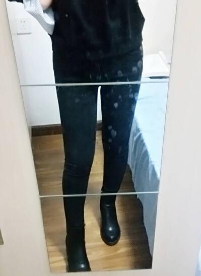 吸脂减肥瘦大腿前后对比图,光纤溶脂瘦大腿最有效的方法真实案例