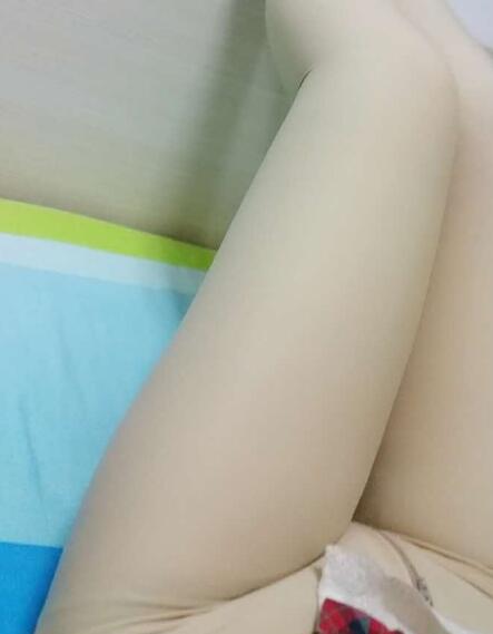 吸脂减肥瘦大腿前后对比图,光纤溶脂瘦大腿最有效的方法真实案例