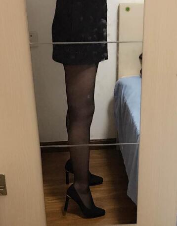 吸脂减肥瘦大腿前后对比图,光纤溶脂瘦大腿最有效的方法真实案例