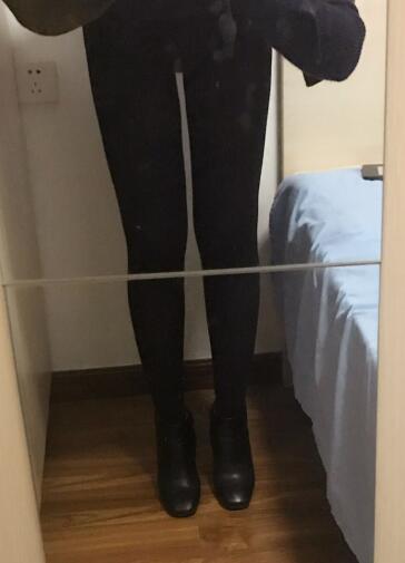 吸脂减肥瘦大腿前后对比图,光纤溶脂瘦大腿最有效的方法真实案例