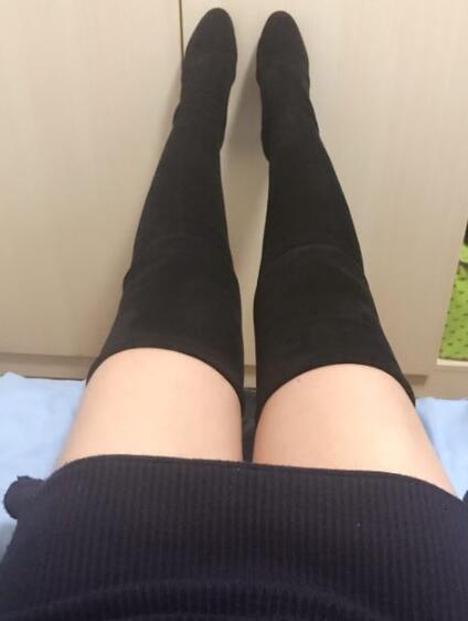 吸脂减肥瘦大腿前后对比图,光纤溶脂瘦大腿最有效的方法真实案例