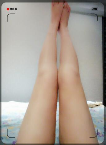 吸脂瘦大腿前后对比图，水动力吸脂瘦大腿真实案例多对比图经历