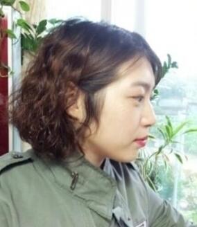 武汉艺龄整形医院做驼峰鼻矫正价格12k,真实案例恢复过程图