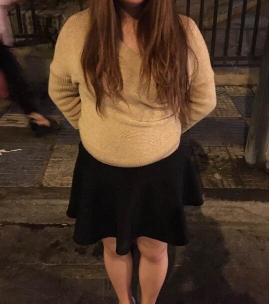 抽脂减肥瘦腰腹手术价格,真实案例前后对比图