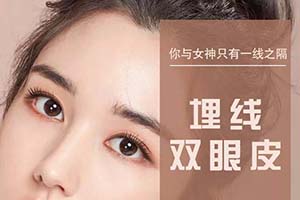 北京466医院整形科埋线双眼皮怎么收费 保持几年 附效果图
