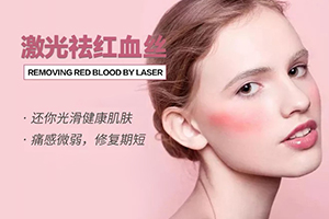 怎么去除脸上红血丝 济南蔡景龙激光去红血丝多少钱