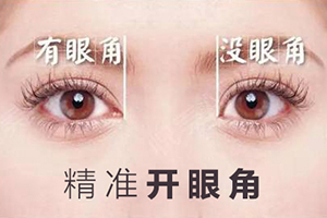大同雨轩开眼角对比图 放大双眸 要多少钱