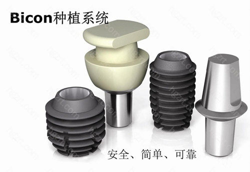 美国百康bicon种植体怎么样？从价格和优势详细解析