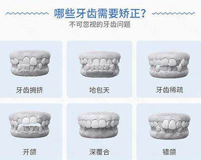 韶关矫正牙齿大概需要多少钱？公布2023韶关牙齿矫正收费标准
